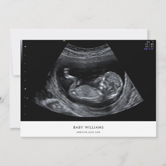 Moderne Minimalistische Sonogram Foto Baby Shower  Kaart (Achterkant)