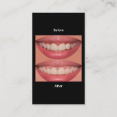 Moderne tandheelkundige Visitekaartjes (Achterkant)