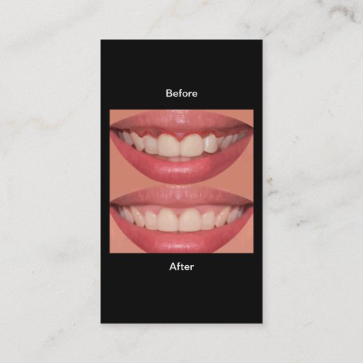 Moderne tandheelkundige Visitekaartjes (Achterkant)