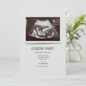 Moderne Ultrasound foto Zwangerschap Aankondiging (Staand voorkant)