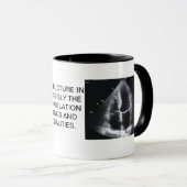 MOK CARDIAC ECHO (Voorkant rechts)