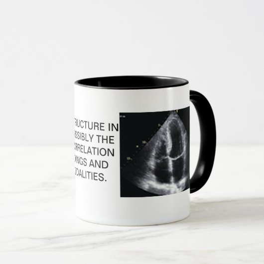 MOK CARDIAC ECHO (Voorkant rechts)