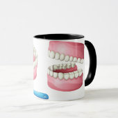 Mok gebitten (Voorkant rechts)