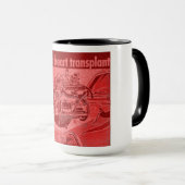 Mok harttransplantatie (Voorkant rechts)