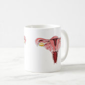 Mok van het voortplantingssysteem van vrouwen (Voorkant rechts)