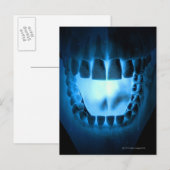Mouth Area Briefkaart (Voorkant / Achterkant)