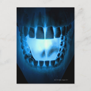 Mouth Area Briefkaart