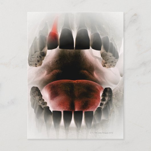 Mouth Briefkaart (Voorkant)