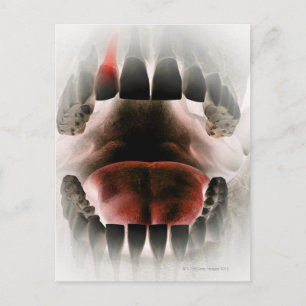 Mouth Briefkaart