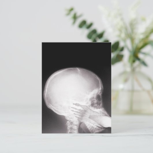 Mouth X-Ray Briefkaart (Staand voorkant)