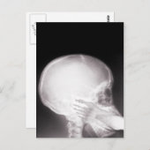Mouth X-Ray Briefkaart (Voorkant / Achterkant)