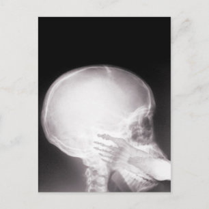 Mouth X-Ray Briefkaart