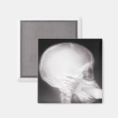 Mouth X-Ray Magneet (Voorkant / Achterkant)