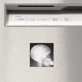 Mouth X-Ray Magneet (Insitu (Vaatwasser))