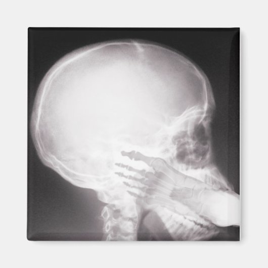 Mouth X-Ray Magneet (Voorkant)