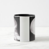 Mouth X-Ray Mok (Midden)