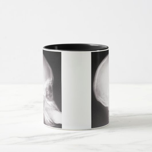 Mouth X-Ray Mok (Midden)