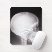 Mouth X-Ray Muismat (Met muis)