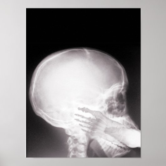 Mouth X-Ray Poster (Voorkant)