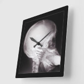 Mouth X-Ray Vierkante Klok (Hoek)