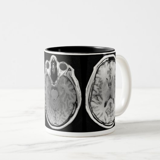 MRI afbeelding mok (Voorkant rechts)