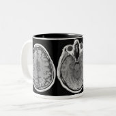 MRI afbeelding mok (Voorkant links)