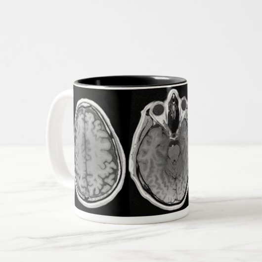 MRI afbeelding mok (Voorkant links)
