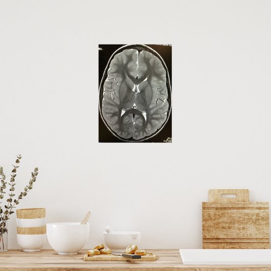 MRI Brain Poster (Keuken)