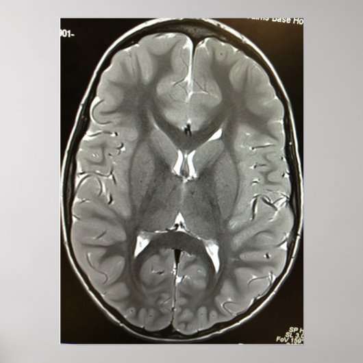 MRI Brain Poster (Voorkant)