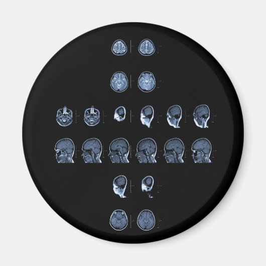 MRI Cross Magneet (Voorkant)