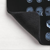 MRI Cross Muismat (Hoek)