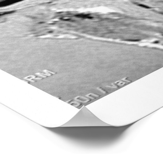 MRI Head Poster (Hoek)