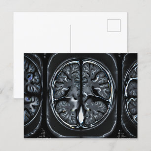 MRI hersenscan Briefkaart