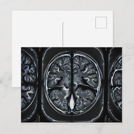 MRI hersenscan Briefkaart (Voorkant / Achterkant)
