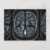 MRI hersenscan Briefkaart (Voorkant)