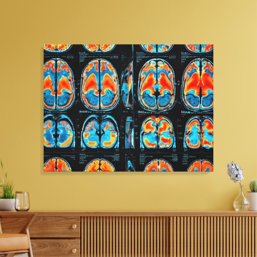 MRI hersenscan Canvas Afdruk (Insitu (Woonkamer))