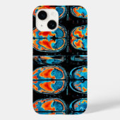 MRI-hersenscan Case-Mate iPhone Case (Achterkant)