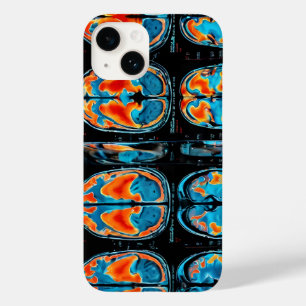 MRI-hersenscan Case-Mate iPhone 14 Hoesje
