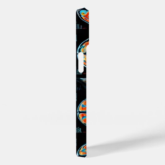 MRI-hersenscan Case-Mate iPhone Case (Achterkant / Rechts)