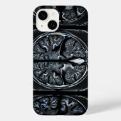 MRI hersenscan Case-Mate iPhone Case (Achterkant)