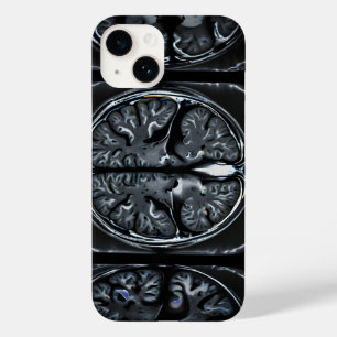 MRI hersenscan Case-Mate iPhone 14 Hoesje