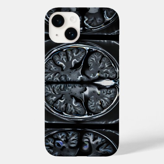 MRI hersenscan Case-Mate iPhone Case (Achterkant)