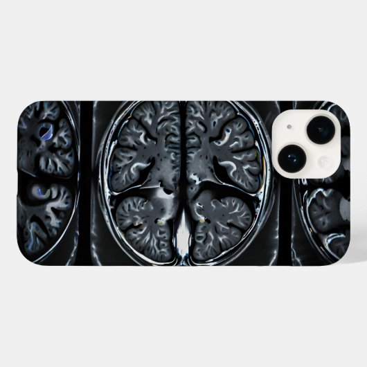 MRI hersenscan Case-Mate iPhone Case (Achterkant (horizontaal))