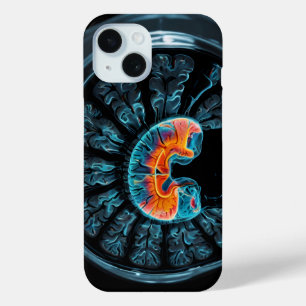 MRI-hersenscan iPhone 15 Case