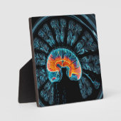 MRI hersenscan Fotoplaat (Voorkant)