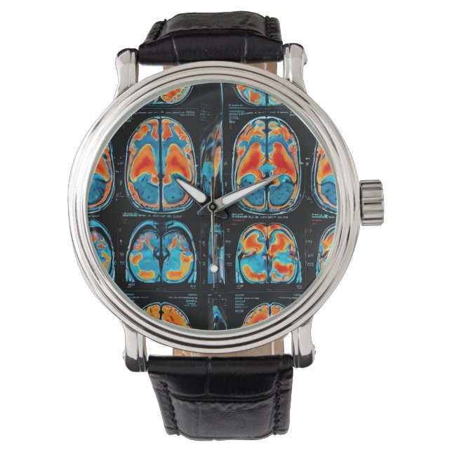 MRI hersenscan Horloge (Voorkant)