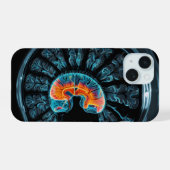 MRI-hersenscan iPhone 15 Case (Achterkant horizontaal)