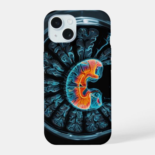 MRI-hersenscan iPhone 15 Case (Achterkant)