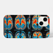 MRI-hersenscan iPhone Hoesje (Achterkant horizontaal)