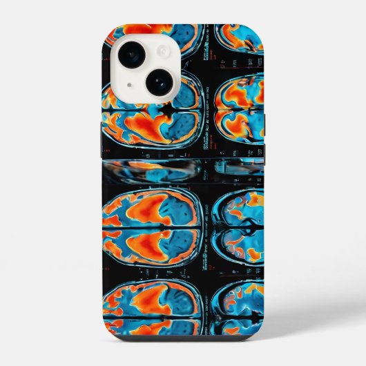MRI-hersenscan iPhone Hoesje (Achterkant)
